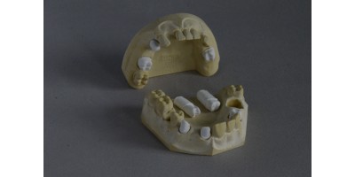 Set of educational casts with occlusion with removable "dies" for framework design and diagnostic wax-up preparation.Art.no.1001-02
